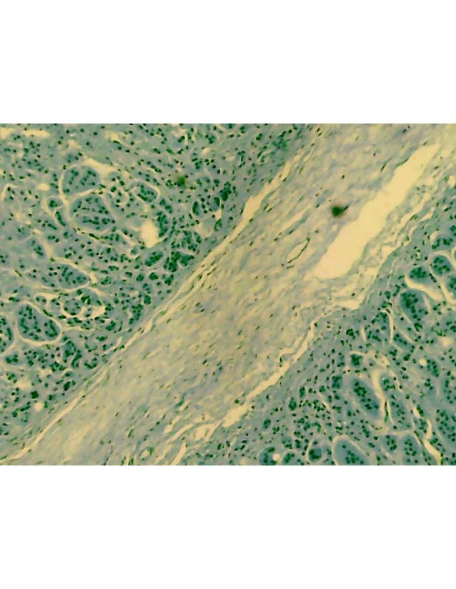 ALGOSLIDEZ 004 - Adrenal Gland